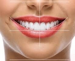 estetica dental sonrisa