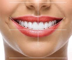 estetica dental sonrisa